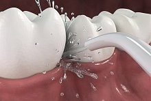 Орошения десен №2 Орошения десен, отдых все включено №2